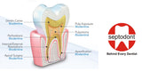 Biodentine_Indications