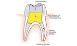 pulpotec-appli