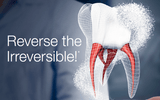 reverse-biodentine